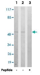 Anti-CPE Rabbit Polyclonal Antibody