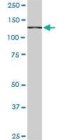 Anti-CAND1 Mouse Monoclonal Antibody [clone: 1G5]