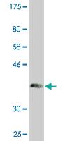 Anti-CHIT1 Mouse Monoclonal Antibody [clone: 1D11]