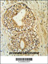 Anti-ATP11C Rabbit Polyclonal Antibody