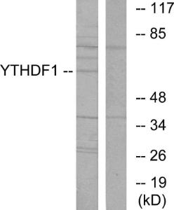 Western blot analysis of lysates from 293 cells using Anti-YTHDF1 Antibody. The right hand lane represents a negative control, where the antibody is blocked by the immunising peptide.