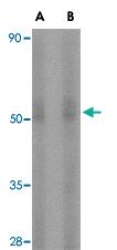 Anti-STEAP3 Rabbit Polyclonal Antibody