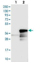 Anti-CHMP6 Rabbit Polyclonal Antibody