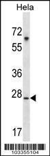 Anti-SRPK1 Rabbit Polyclonal Antibody (Biotin)