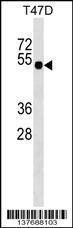 Anti-GLI4 Rabbit Polyclonal Antibody (AP (Alkaline Phosphatase))