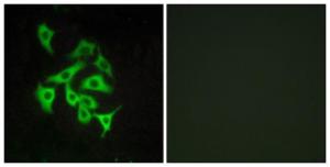 Anti-GPCR GPR100 Rabbit Polyclonal Antibody