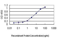 Anti-HORMAD1 Mouse Monoclonal Antibody [clone: 2E5]