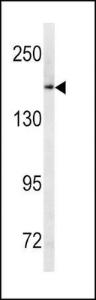 Anti-MRP Rabbit Polyclonal Antibody