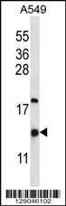 Anti-HIGD2A Rabbit Polyclonal Antibody (AP (Alkaline Phosphatase))