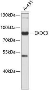 Western blot analysis of extracts of A-431 cells, using Anti-rSec6 Antibody (A9483). The secondary antibody was Goat Anti-Rabbit IgG H&L Antibody (HRP) at 1:10,000 dilution. Lysates/proteins were present at 25µg per lane. The blocking buffer used was 3% non-fat dry milk in TBST.