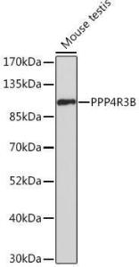 Western blot analysis of extracts of Mouse testis, using Anti-SMEK2 Antibody (A93300) at 1:500 dilution. The secondary antibody was Goat Anti-Rabbit IgG H&L Antibody (HRP) at 1:10,000 dilution.