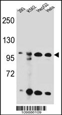 Anti-KSR2 Rabbit Polyclonal Antibody [clone: 302CT2.3.2]