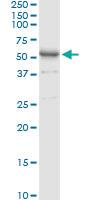 Anti-AMY1C Rabbit Polyclonal Antibody