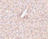 Anti-STEAP3 Rabbit Polyclonal Antibody