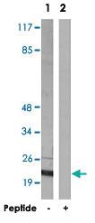 Anti-CDC42EP5 Rabbit Polyclonal Antibody