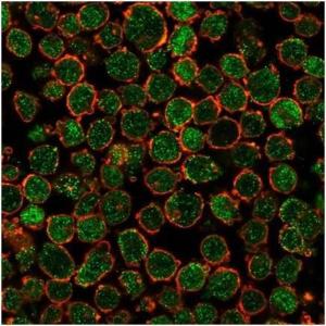 Antibody anti-CHEK2 pcrp-CHEK2-1A4 100 µg