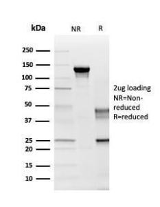 SDS-PAGE analysis of Anti-Myelin PLP Antibody [PLP1/4259] under non-reduced and reduced conditions; showing intact IgG and intact heavy and light chains, respectively. SDS-PAGE analysis confirms the integrity and purity of the Antibody