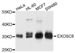 Western blot analysis of extracts of various cell lines, using Anti-EXOSC8 Antibody (A4507) at 1:1,000 dilution