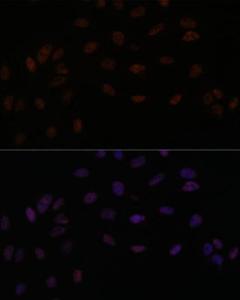 Immunofluorescence analysis of U-2 OS cells using Anti-SMEK2 Antibody (A93300) at a dilution of 1:100. DAPI was used to stain the cell nuclei (blue).