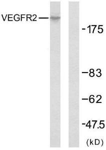 Western blot analysis of lysates from SK-OV3 cells using Anti-VEGFR2 Antibody. The right hand lane represents a negative control, where the antibody is blocked by the immunising peptide.