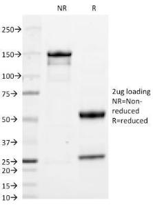 SDS-PAGE analysis of Anti-Human IgA Heavy Chain Antibody [HISA43] under non-reduced and reduced conditions; showing intact IgG and intact heavy and light chains, respectively. SDS-PAGE analysis confirms the integrity and purity of the antibody