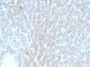 Anti-HSP60 antibody