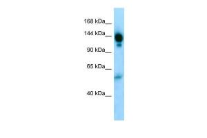 Anti-A2M Rabbit Polyclonal Antibody