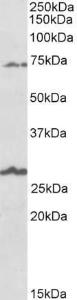 Antibody anti-SLC6A12 100 µg