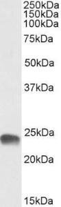 Anti-GSTA3 Antibody (A85265) (0.3 µg/ml) staining of Human Placenta lysate (35 µg protein in RIPA buffer). Primary incubation was 1 hour. Detected by chemilu minescence