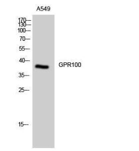 Anti-GPCR GPR100 Rabbit Polyclonal Antibody