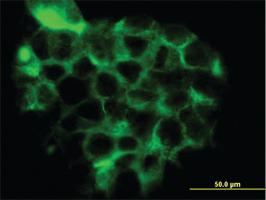 Anti-RRAS2 Mouse Monoclonal Antibody [clone: 2D3-4B8]