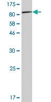 Anti-PKM Mouse Monoclonal Antibody [clone: 5D2-3B3]