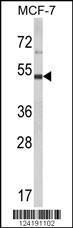 Anti-LUC7L2 Rabbit Polyclonal Antibody (HRP (Horseradish Peroxidase))