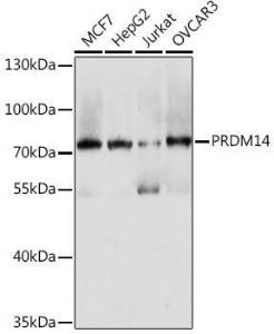 Western blot analysis of extracts of various cell lines, using Anti-PRDM14 Antibody (A93301) at 1:1,000 dilution The secondary antibody was Goat Anti-Rabbit IgG H&L Antibody (HRP) at 1:10,000 dilution Lysates/proteins were present at 25 µg per lane