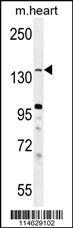 Anti-KDM3B Rabbit Polyclonal Antibody [clone: 303CT19.9.2]