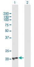 Anti-CBFB Mouse Polyclonal Antibody