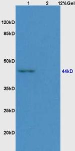 Anti-CD209A Rabbit Polyclonal Antibody