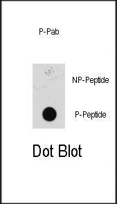 Anti-MAP2K1 Rabbit Polyclonal Antibody (Biotin)