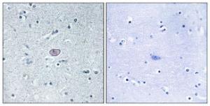 Immunohistochemical analysis of paraffin-embedded human brain tissue using Anti-VEGFR2 Antibody. The right hand panel represents a negative control, where the antibody was pre-incubated with the immunising peptide.