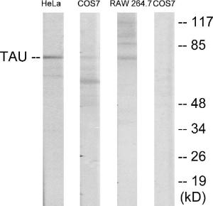 Western blot analysis of lysates from HeLa, COS7, and RAW246.7 cells using Anti-Tau Antibody. The right hand lane represents a negative control, where the antibody is blocked by the immunising peptide