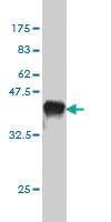 Anti-CDH1 Mouse Monoclonal Antibody [clone: 3F4]