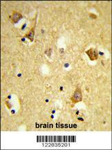 Anti-APOBEC3F Rabbit Polyclonal Antibody (FITC (Fluorescein Isothiocyanate))