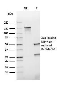 Anti-HSP60 antibody