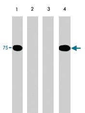 Anti-PAK6 Rabbit Polyclonal Antibody