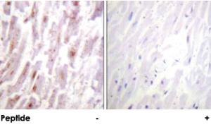 Anti-CRYAB Rabbit Polyclonal Antibody