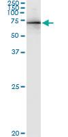 Anti-AHI1 Polyclonal Antibody Pair