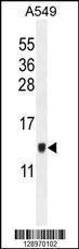 Anti-KTAP2 Rabbit Polyclonal Antibody (APC (Allophycocyanin))