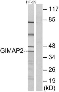 Western blot analysis of lysates from HT-29 cells using Anti-GIMAP2 Antibody. The right hand lane represents a negative control, where the antibody is blocked by the immunising peptide