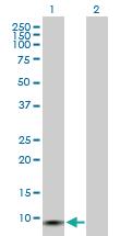 Anti-GCHFR Rabbit Polyclonal Antibody