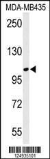 Anti-LUZP1 Rabbit Polyclonal Antibody (APC (Allophycocyanin))